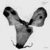 Dyscamupia
