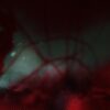 Shamania (Inc Villalobos & Melchior and Dunkle Dummies Remixes)